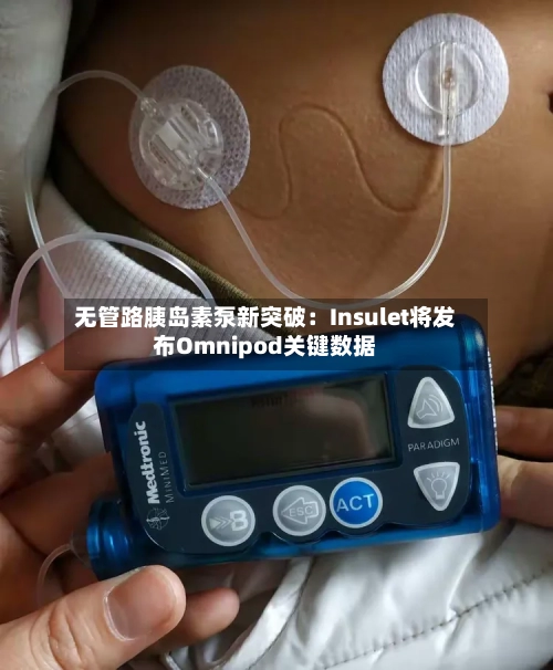 无管路胰岛素泵新突破：Insulet将发布Omnipod关键数据